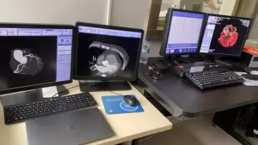 Yozgat’ta Koroner BT Anjiyografi Dönemi